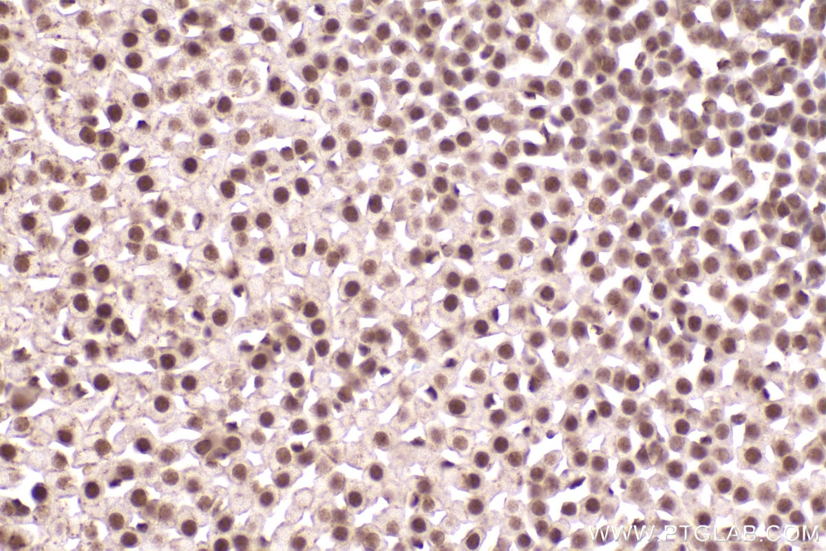 Immunohistochemical analysis of paraffin-embedded mouse adrenal gland tissue slide using KHC2469 (MEF2D IHC Kit).