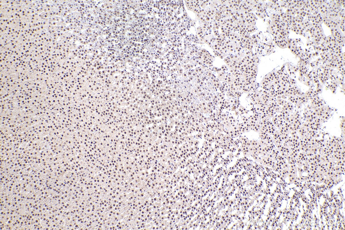 Immunohistochemical analysis of paraffin-embedded rat adrenal gland tissue slide using KHC2469 (MEF2D IHC Kit).