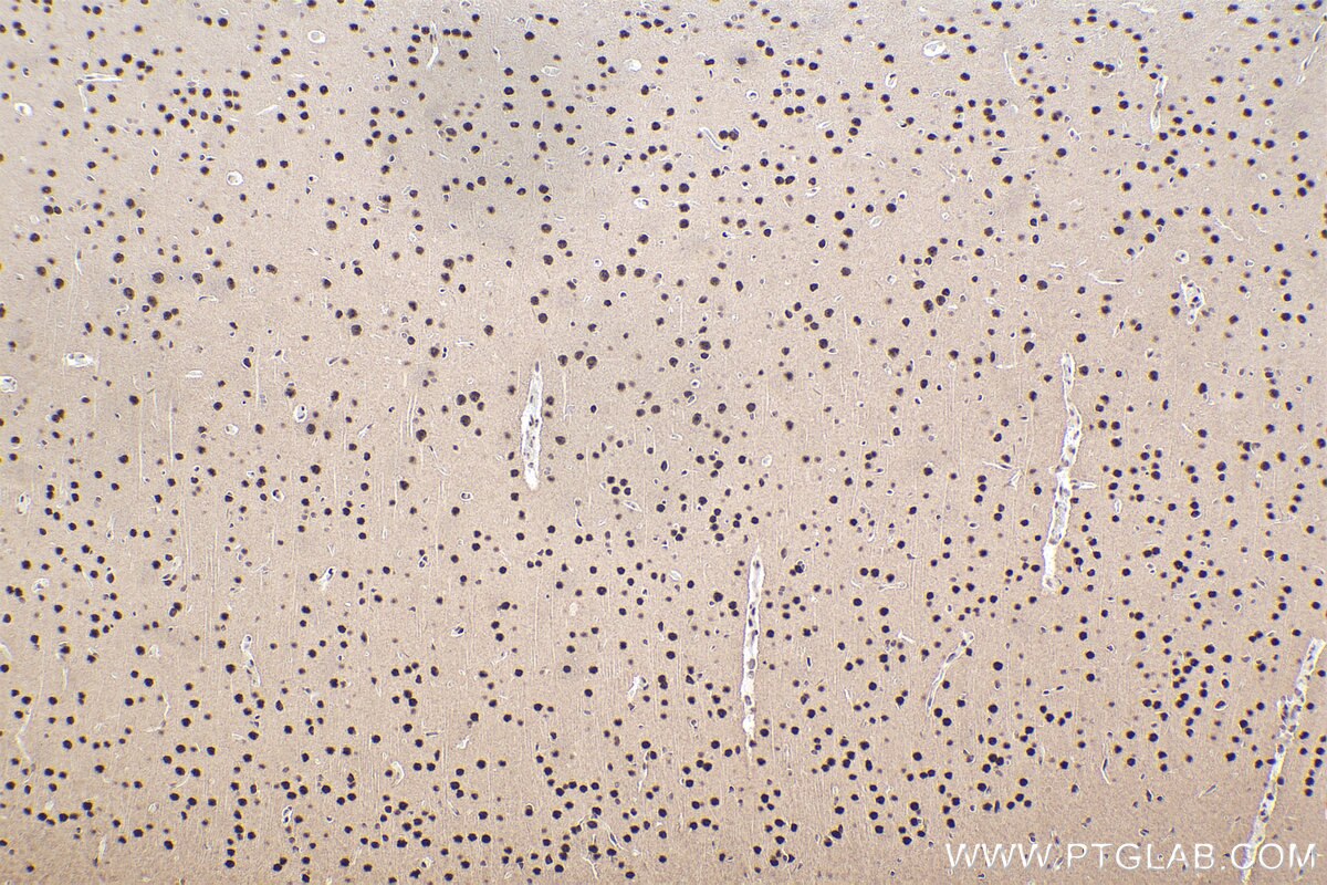 Immunohistochemical analysis of paraffin-embedded rat brain tissue slide using KHC2469 (MEF2D IHC Kit).