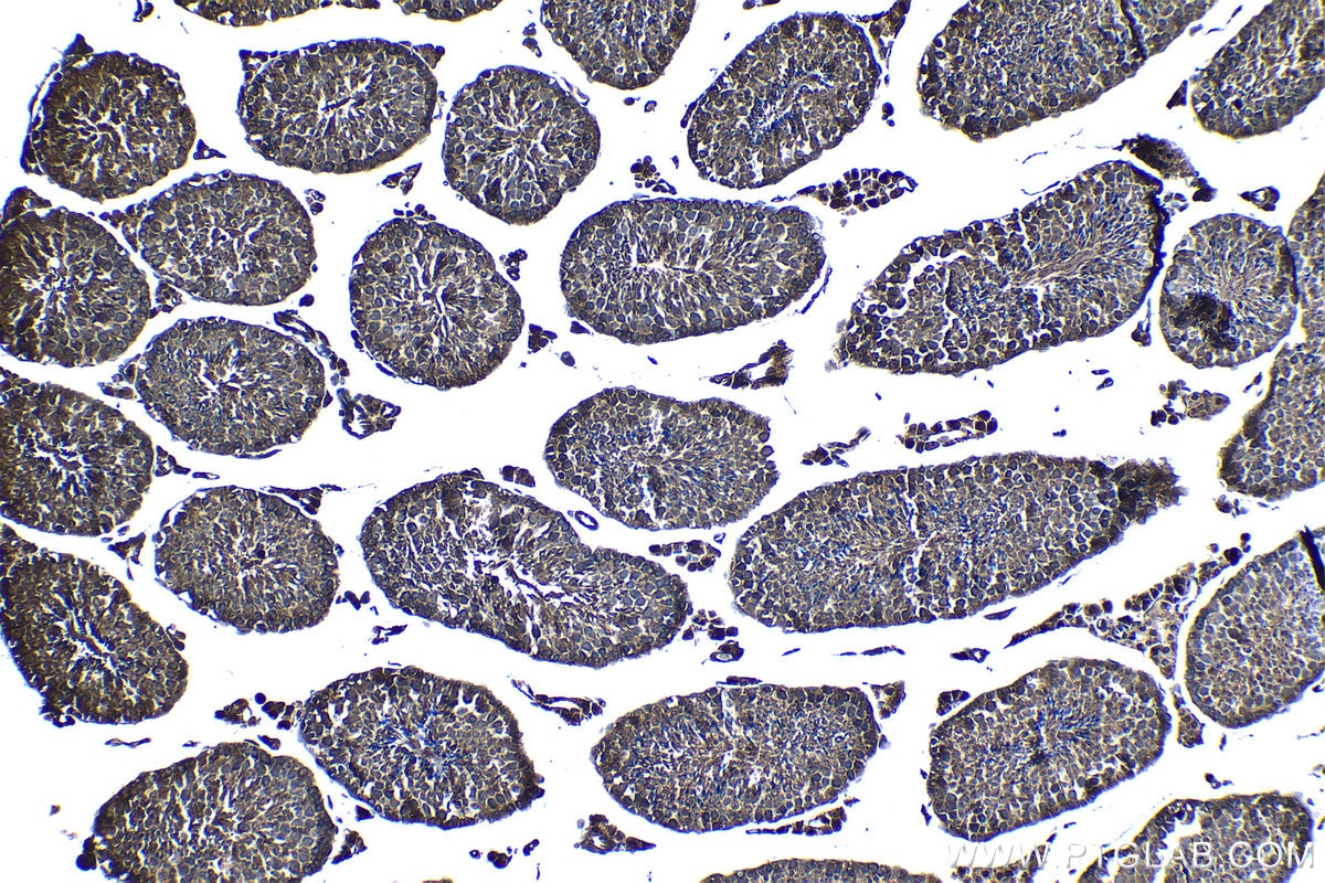 Immunohistochemical analysis of paraffin-embedded mouse testis tissue slide using KHC1261 (MEI1 IHC Kit).