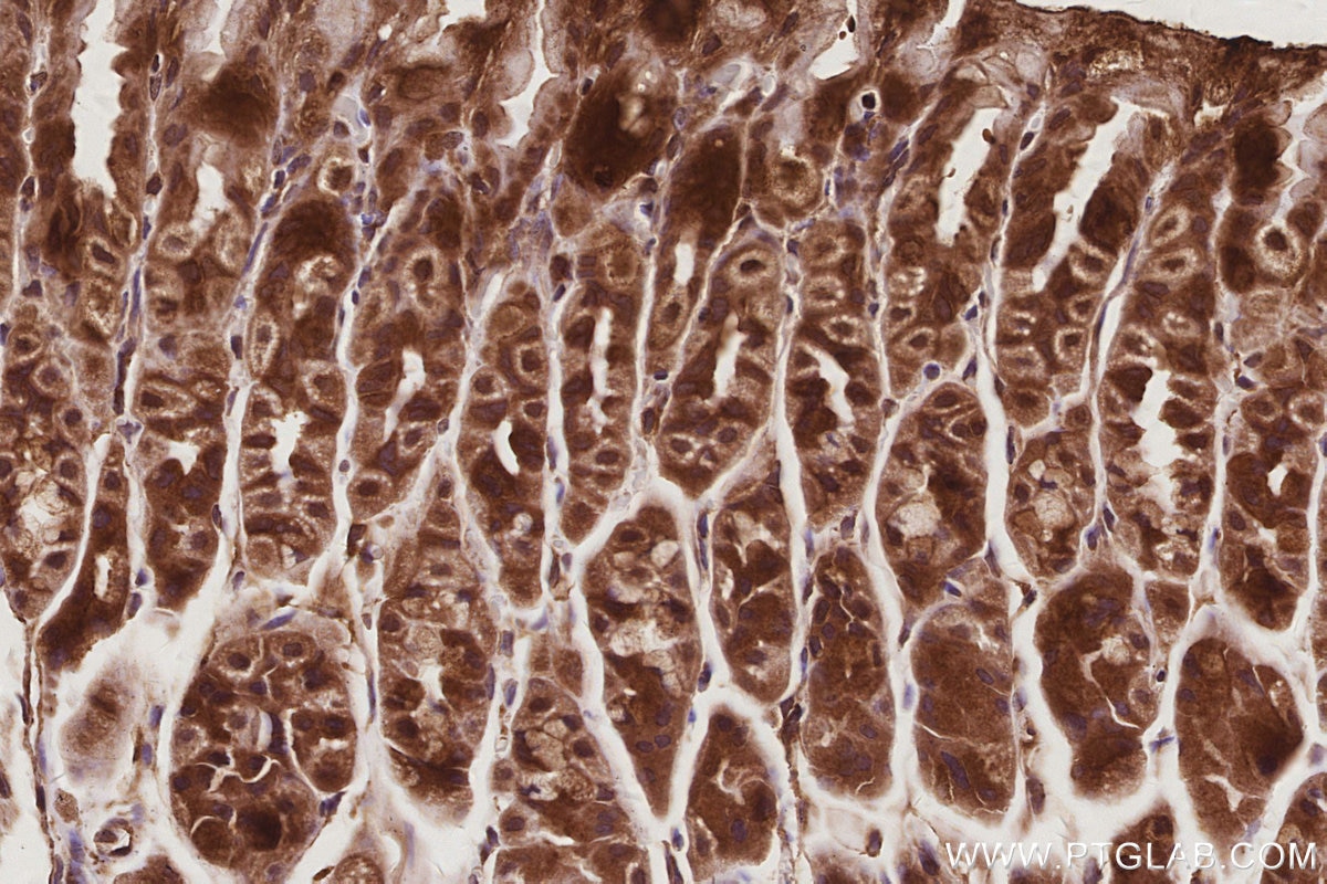 Immunohistochemical analysis of paraffin-embedded mouse stomach tissue slide using KHC3058 (MEKK2 IHC Kit). Immunohistochemical analysis of paraffin-embedded mouse stomach tissue slide using KHC3058 (MEKK2 IHC Kit).