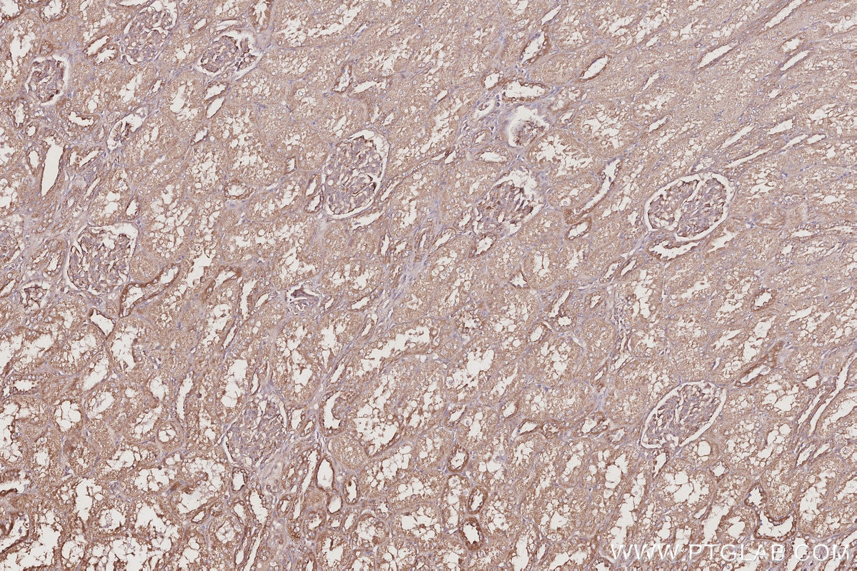 Immunohistochemical analysis of paraffin-embedded human kidney tissue slide using KHC3058 (MEKK2 IHC Kit). Immunohistochemical analysis of paraffin-embedded human kidney tissue slide using KHC3058 (MEKK2 IHC Kit).
