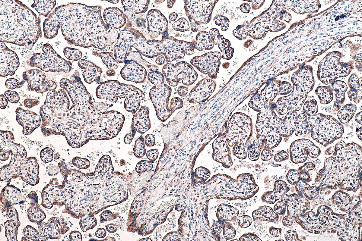 Immunohistochemical analysis of paraffin-embedded human placenta tissue slide using KHC0250 (MEST IHC Kit).