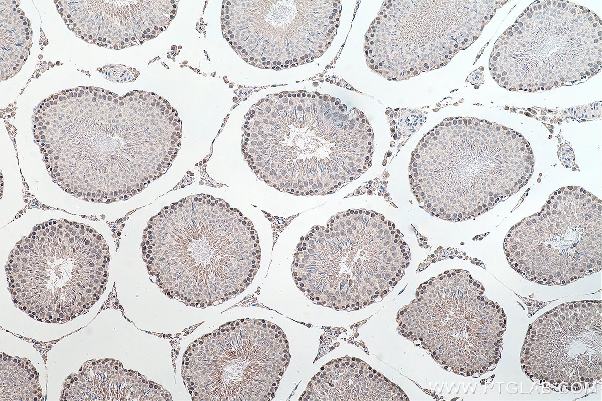 Immunohistochemical analysis of paraffin-embedded rat testis tissue slide using KHC0144 (METTL1 IHC Kit).