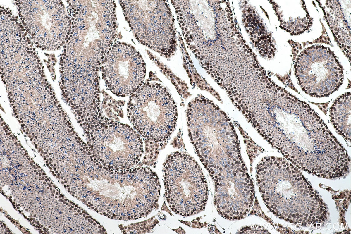 Immunohistochemical analysis of paraffin-embedded mouse testis tissue slide using KHC0144 (METTL1 IHC Kit).