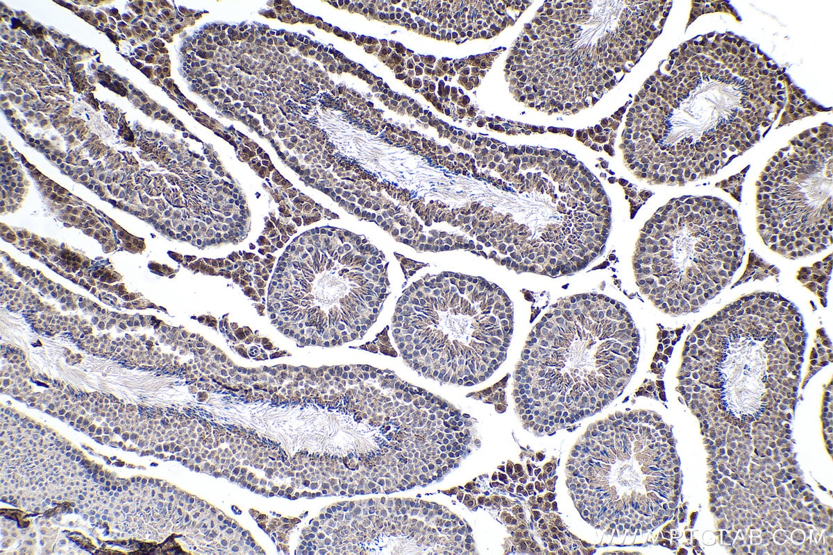 Immunohistochemical analysis of paraffin-embedded mouse testis tissue slide using KHC0146 (METTL16 IHC Kit).