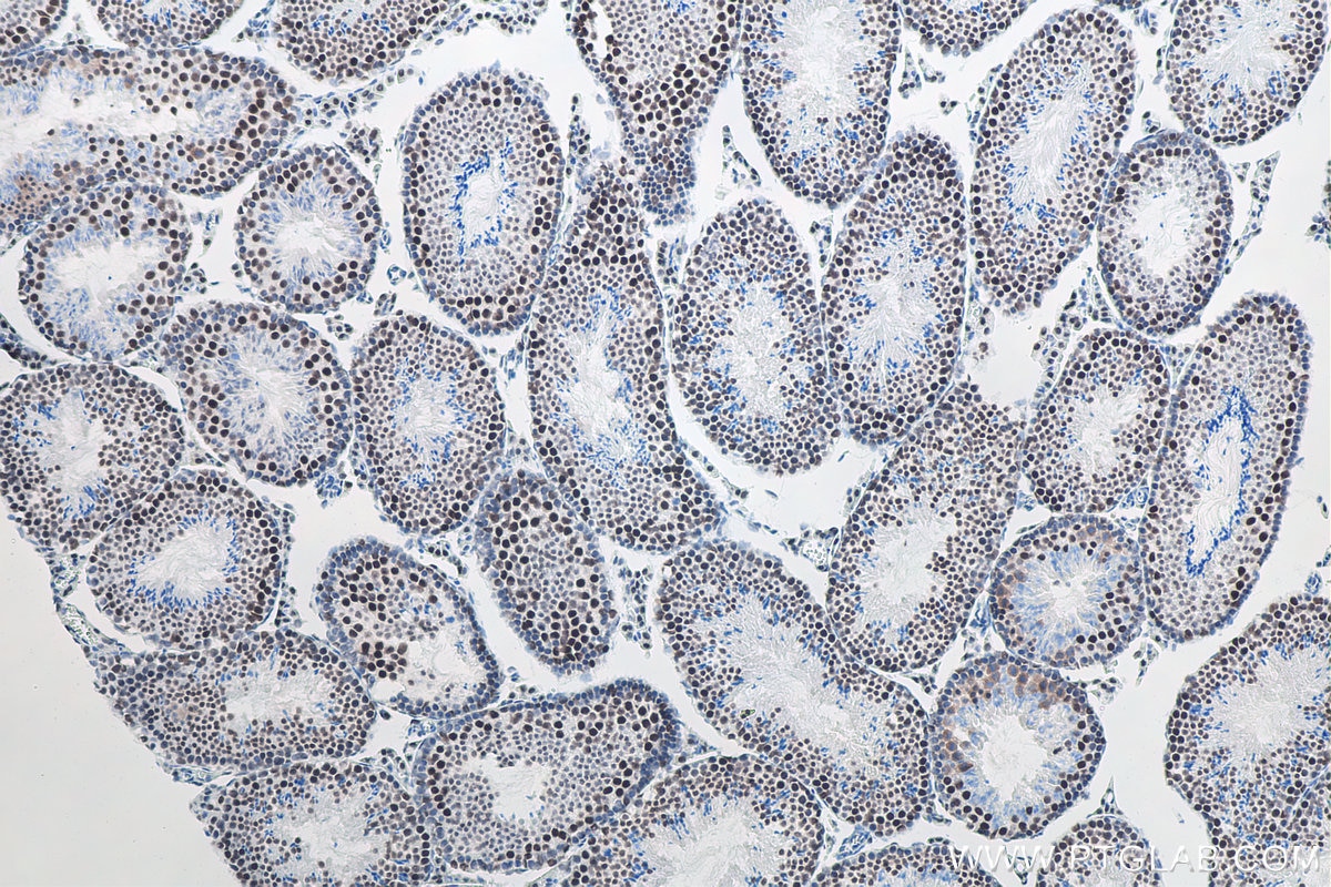 Immunohistochemical analysis of paraffin-embedded mouse testis tissue slide using KHC0061 (METTL3 IHC Kit).