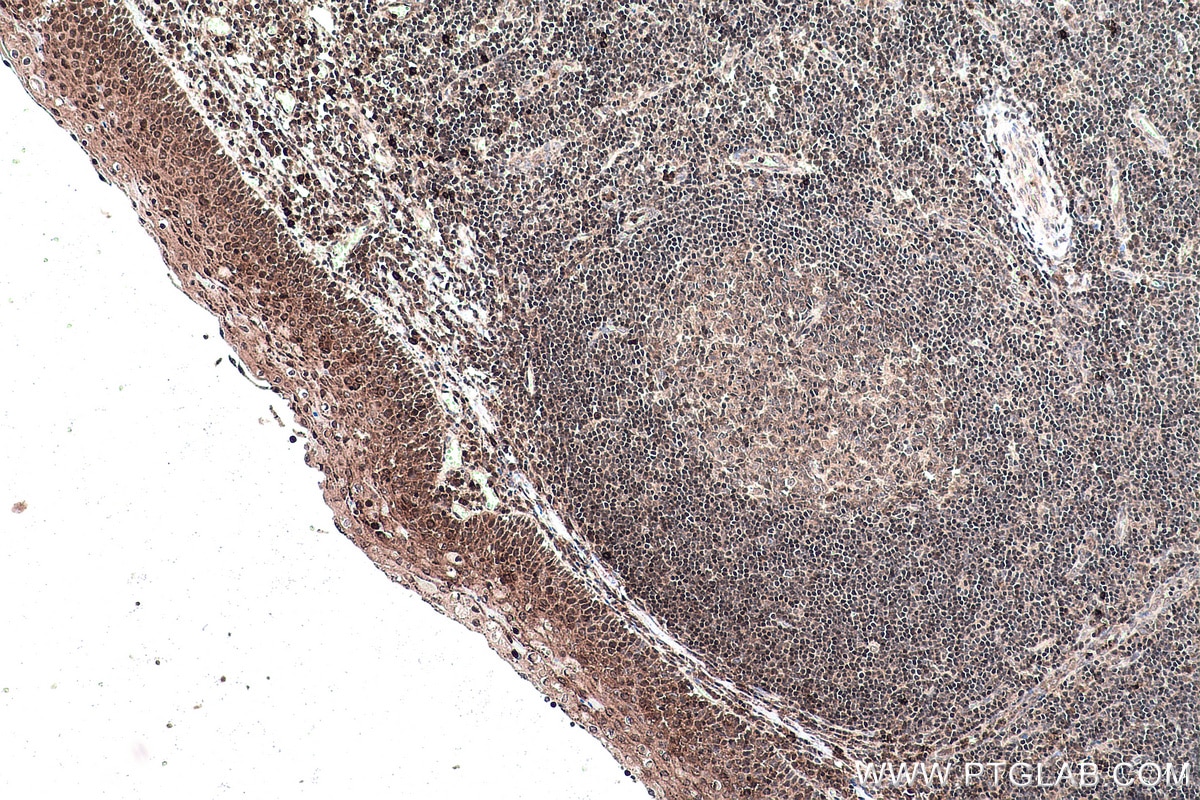 Immunohistochemical analysis of paraffin-embedded human tonsillitis tissue slide using KHC0147 (METTL5 IHC Kit).