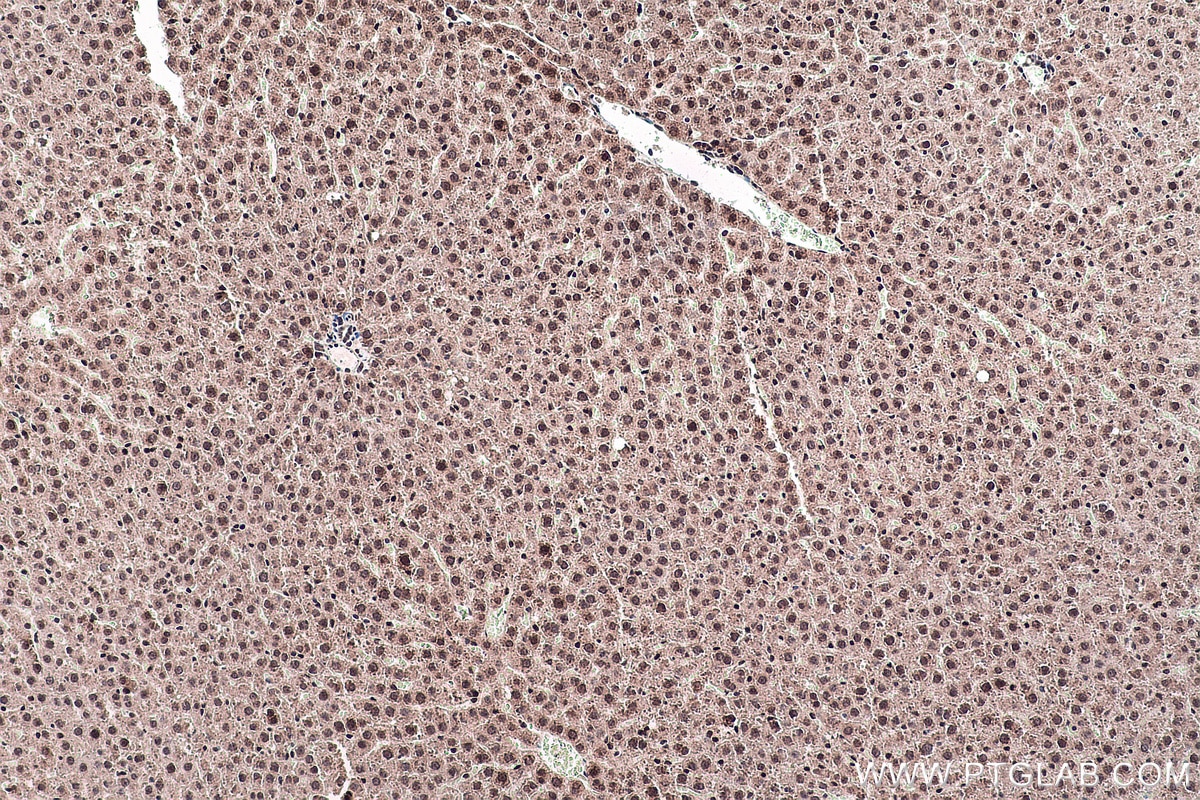 Immunohistochemical analysis of paraffin-embedded rat liver tissue slide using KHC0147 (METTL5 IHC Kit).