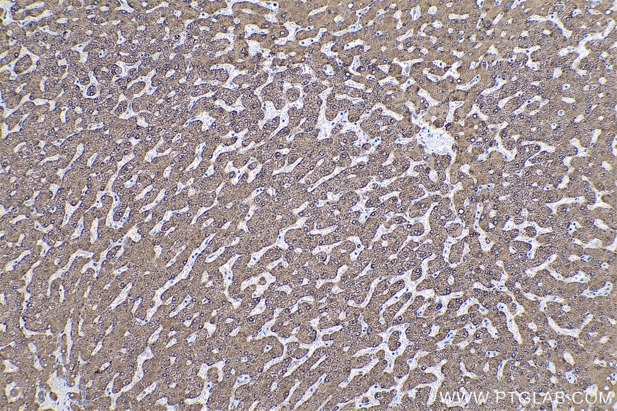 Immunohistochemical analysis of paraffin-embedded human liver tissue slide using KHC0532 (METTL7A IHC Kit).