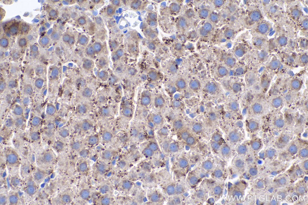 Immunohistochemical analysis of paraffin-embedded rat liver tissue slide using KHC0532 (METTL7A IHC Kit).