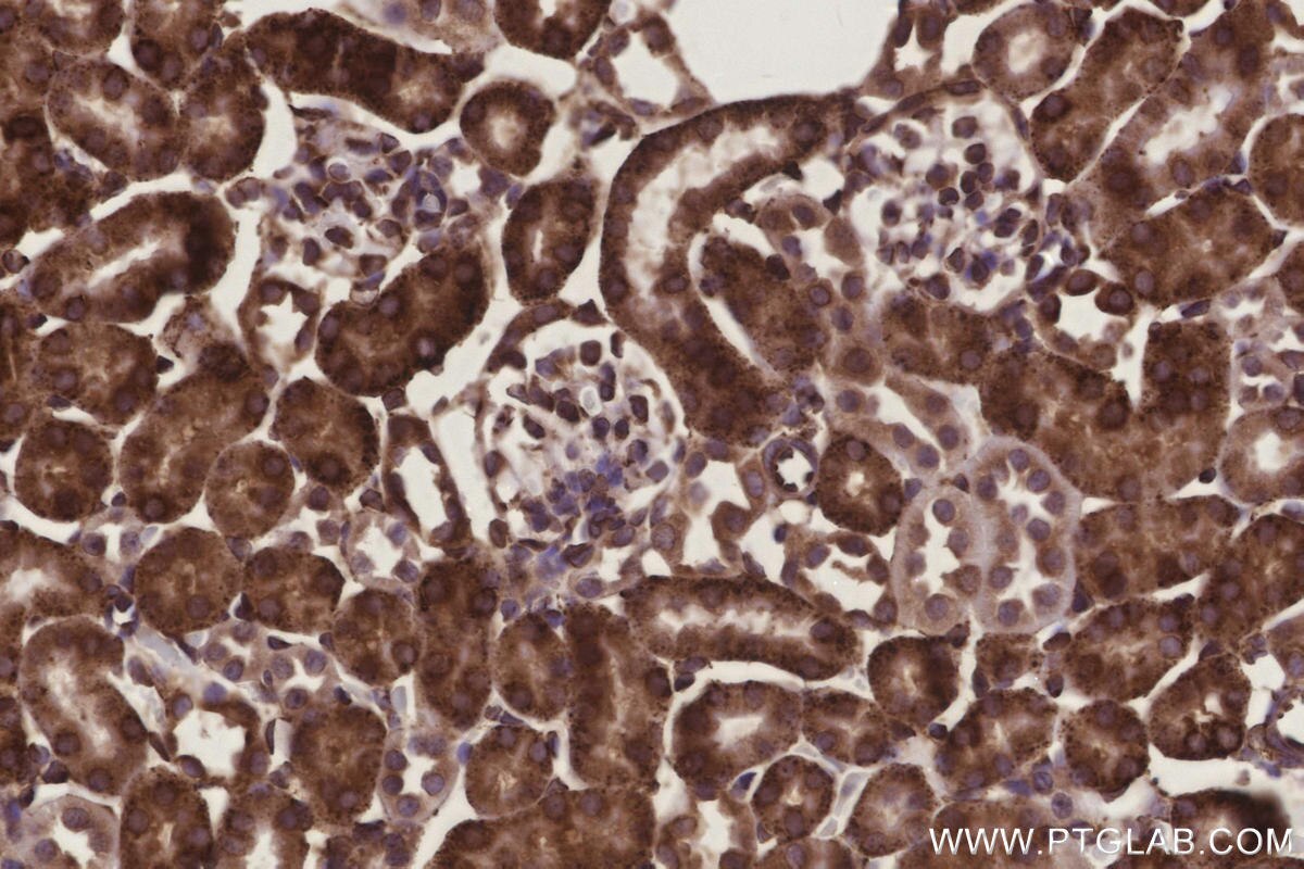 Immunohistochemical analysis of paraffin-embedded mouse kidney tissue slide using KHC3275 (METTL7B IHC Kit).