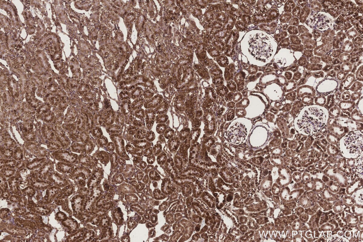 Immunohistochemical analysis of paraffin-embedded rat kidney tissue slide using KHC3275 (METTL7B IHC Kit).