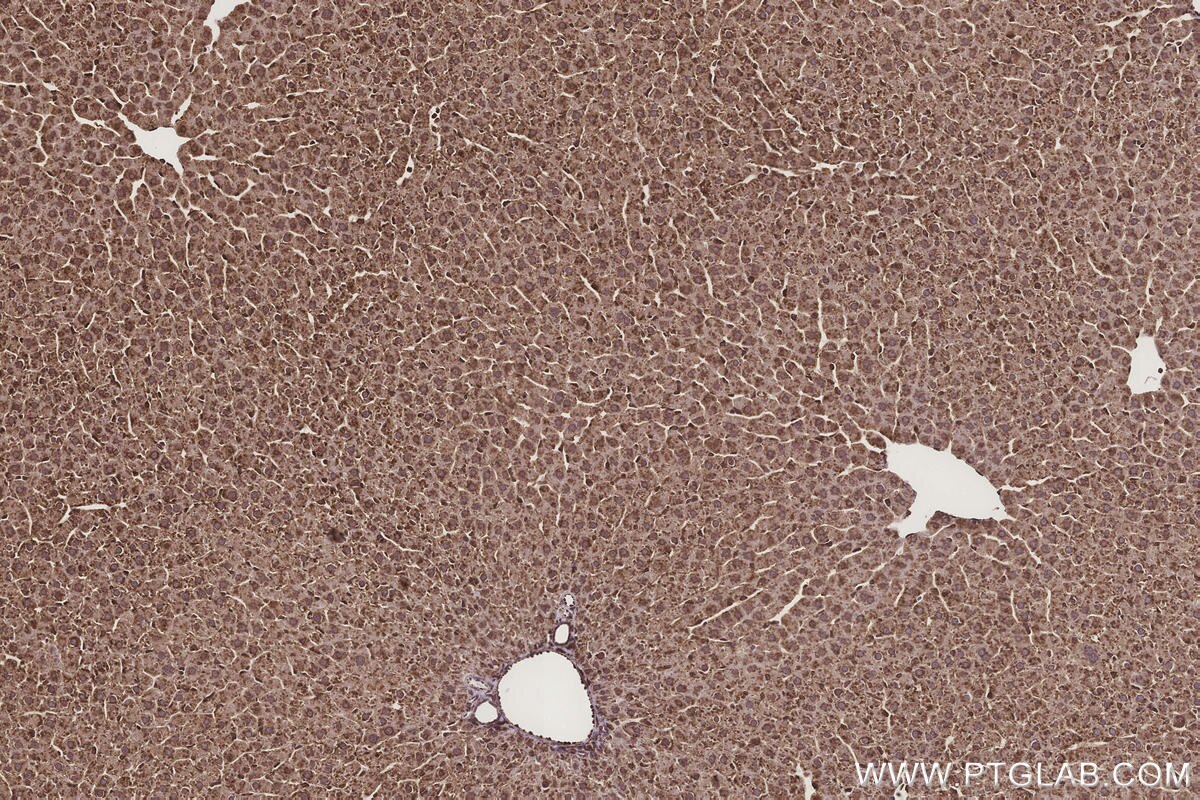 Immunohistochemical analysis of paraffin-embedded rat liver tissue slide using KHC3275 (METTL7B IHC Kit).