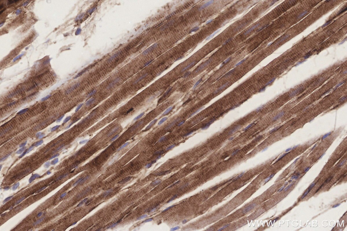 Immunohistochemical analysis of paraffin-embedded rat heart tissue slide using KHC3248 (MGAT2 IHC Kit). Immunohistochemical analysis of paraffin-embedded rat heart tissue slide using KHC3248 (MGAT2 IHC Kit).
