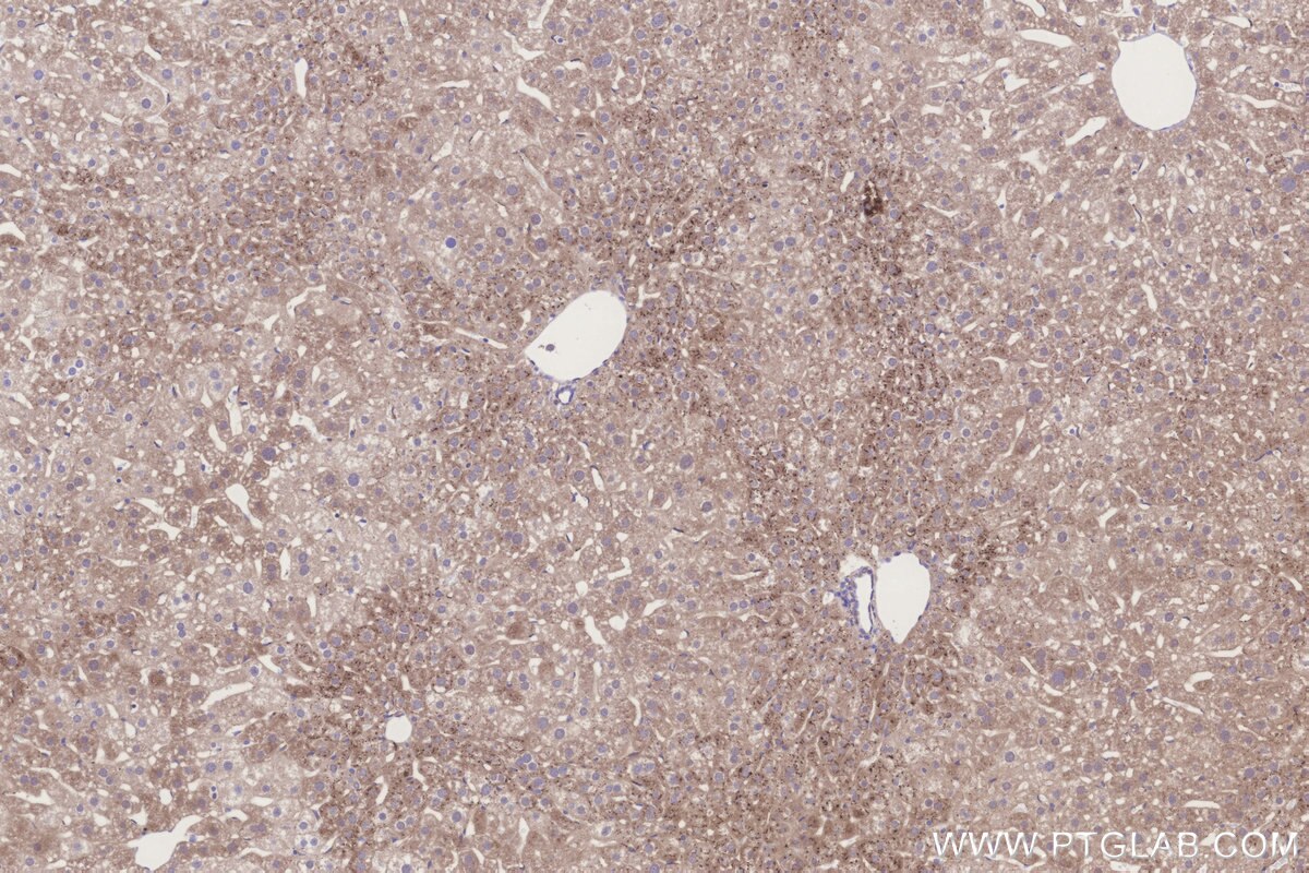 Immunohistochemical analysis of paraffin-embedded mouse liver tissue slide using KHC3248 (MGAT2 IHC Kit). Immunohistochemical analysis of paraffin-embedded mouse liver tissue slide using KHC3248 (MGAT2 IHC Kit).