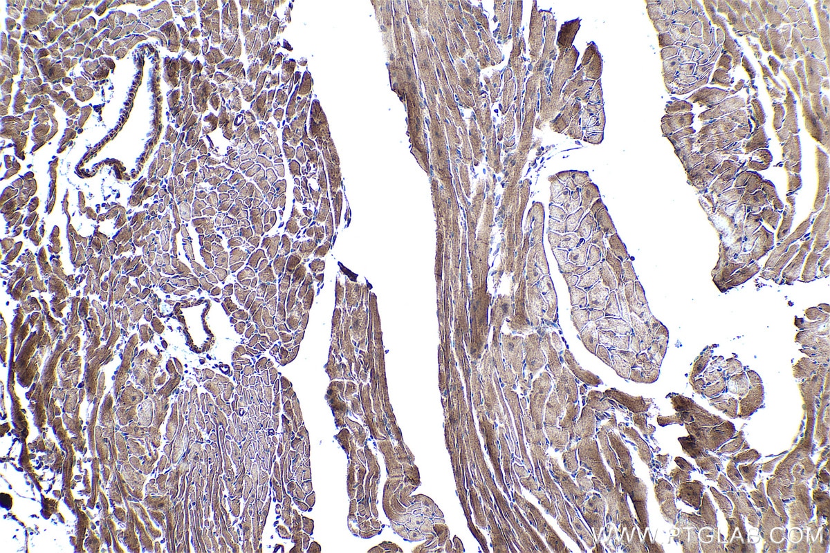 Immunohistochemical analysis of paraffin-embedded mouse heart tissue slide using KHC0435 (MGLL IHC Kit).