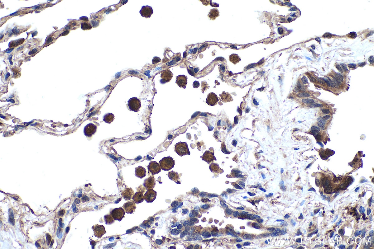 Immunohistochemical analysis of paraffin-embedded human lung tissue slide using KHC0435 (MGLL IHC Kit).