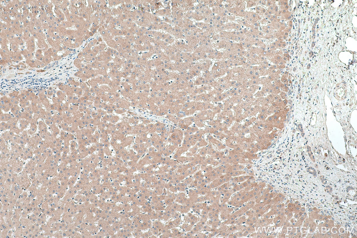 Immunohistochemical analysis of paraffin-embedded human liver tissue slide using KHC0435 (MGLL IHC Kit).