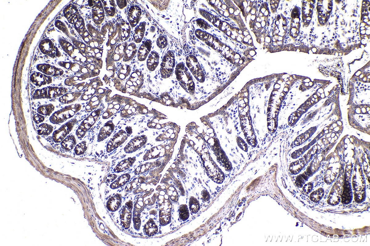 Immunohistochemical analysis of paraffin-embedded mouse colon tissue slide using KHC1484 (MICAL2 IHC Kit).
