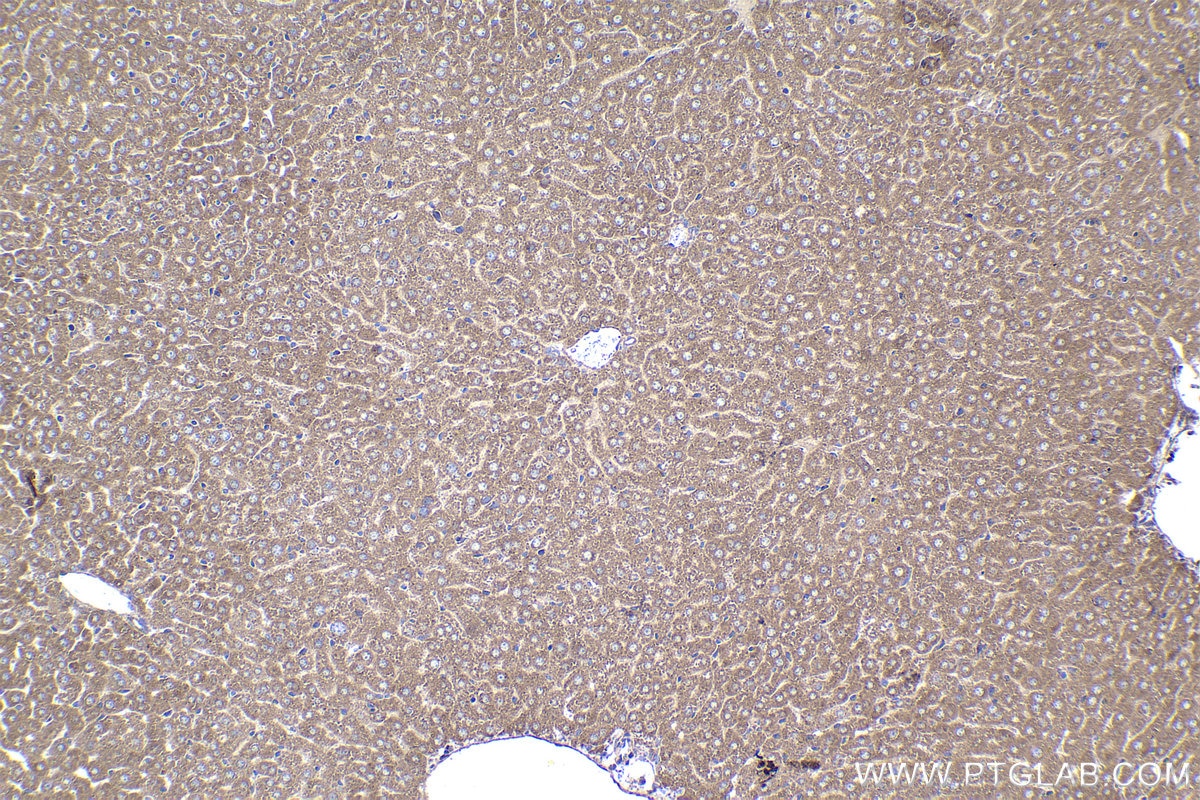 Immunohistochemical analysis of paraffin-embedded mouse liver tissue slide using KHC1484 (MICAL2 IHC Kit).