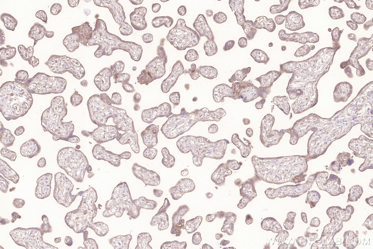 Immunohistochemical analysis of paraffin-embedded human placenta tissue slide using KHC3277 (MIGA2/FAM73B IHC Kit).