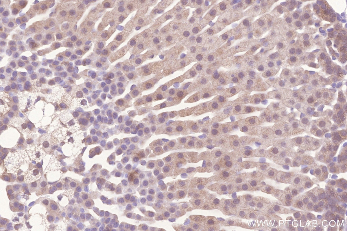 Immunohistochemical analysis of paraffin-embedded mouse adrenal gland tissue slide using KHC3277 (MIGA2/FAM73B IHC Kit).