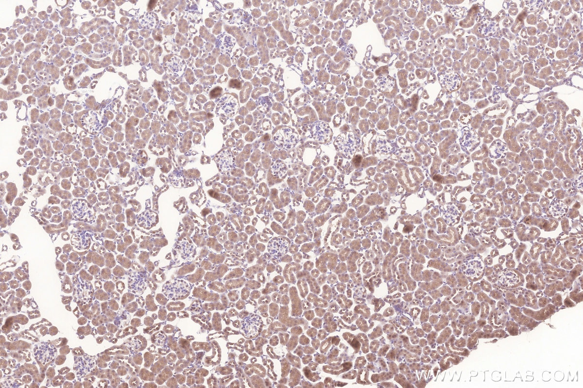 Immunohistochemical analysis of paraffin-embedded mouse kidney tissue slide using KHC3277 (MIGA2/FAM73B IHC Kit).