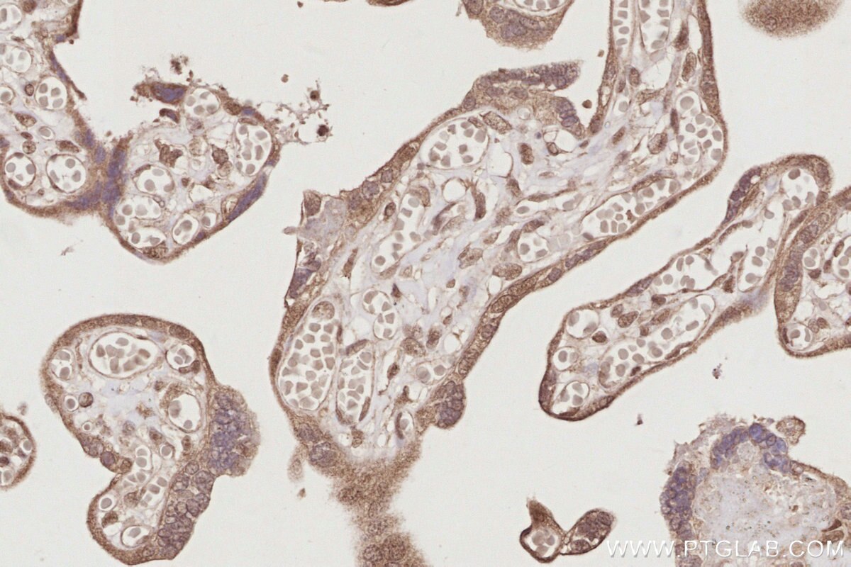 Immunohistochemical analysis of paraffin-embedded human placenta tissue slide using KHC2898 (MIS12 IHC Kit).