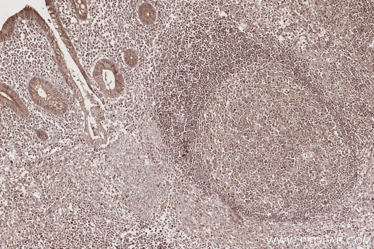Immunohistochemical analysis of paraffin-embedded human appendicitis tissue slide using KHC2734 (MITD1 IHC Kit).