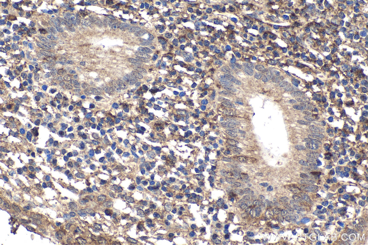 Immunohistochemical analysis of paraffin-embedded human appendicitis tissue slide using KHC1957 (MKKS IHC Kit).