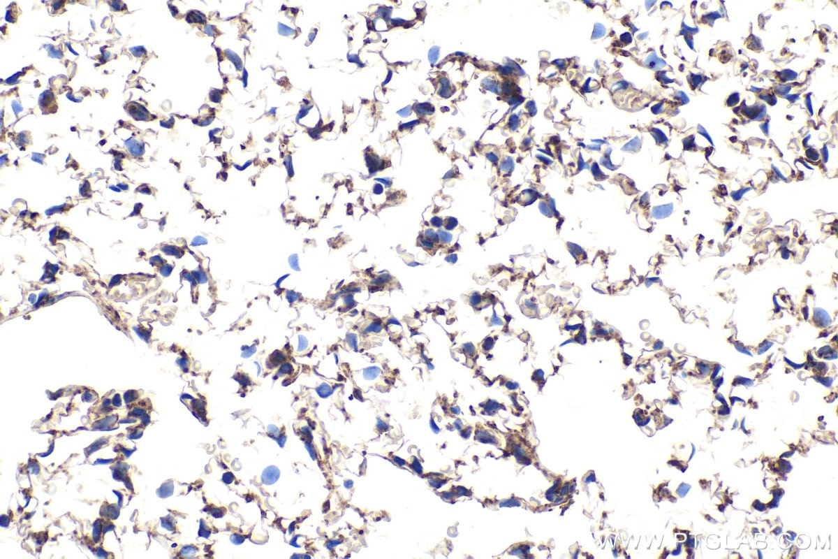 Immunohistochemical analysis of paraffin-embedded rat lung tissue slide using KHC1957 (MKKS IHC Kit).