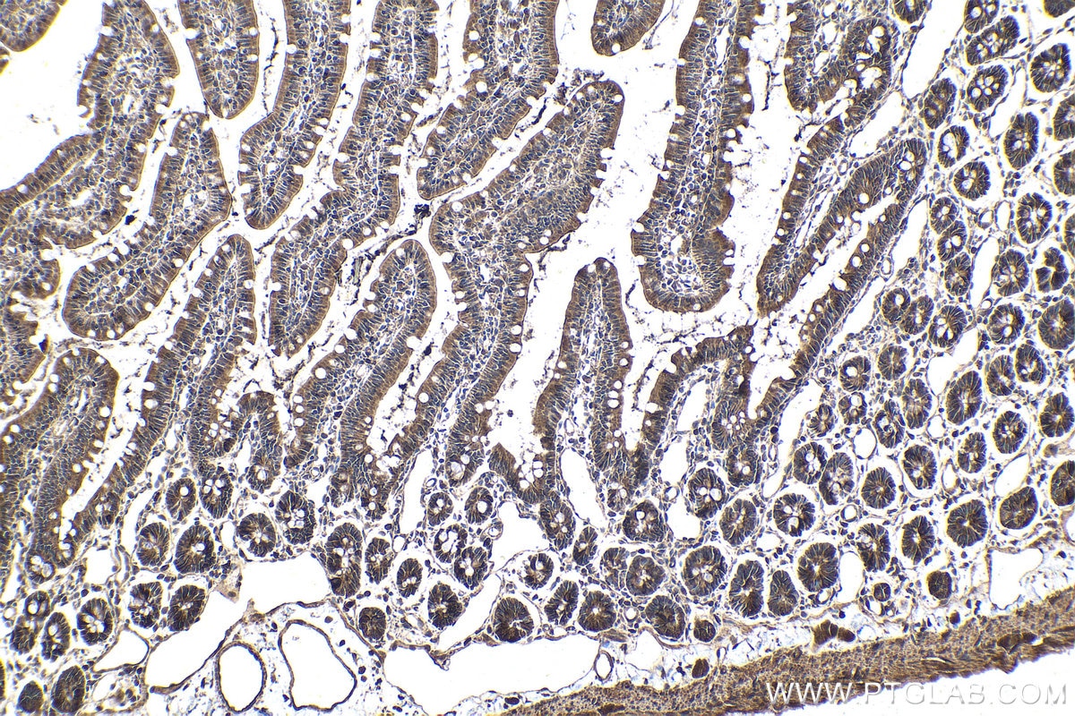 Immunohistochemical analysis of paraffin-embedded rat small intestine tissue slide using KHC1957 (MKKS IHC Kit).