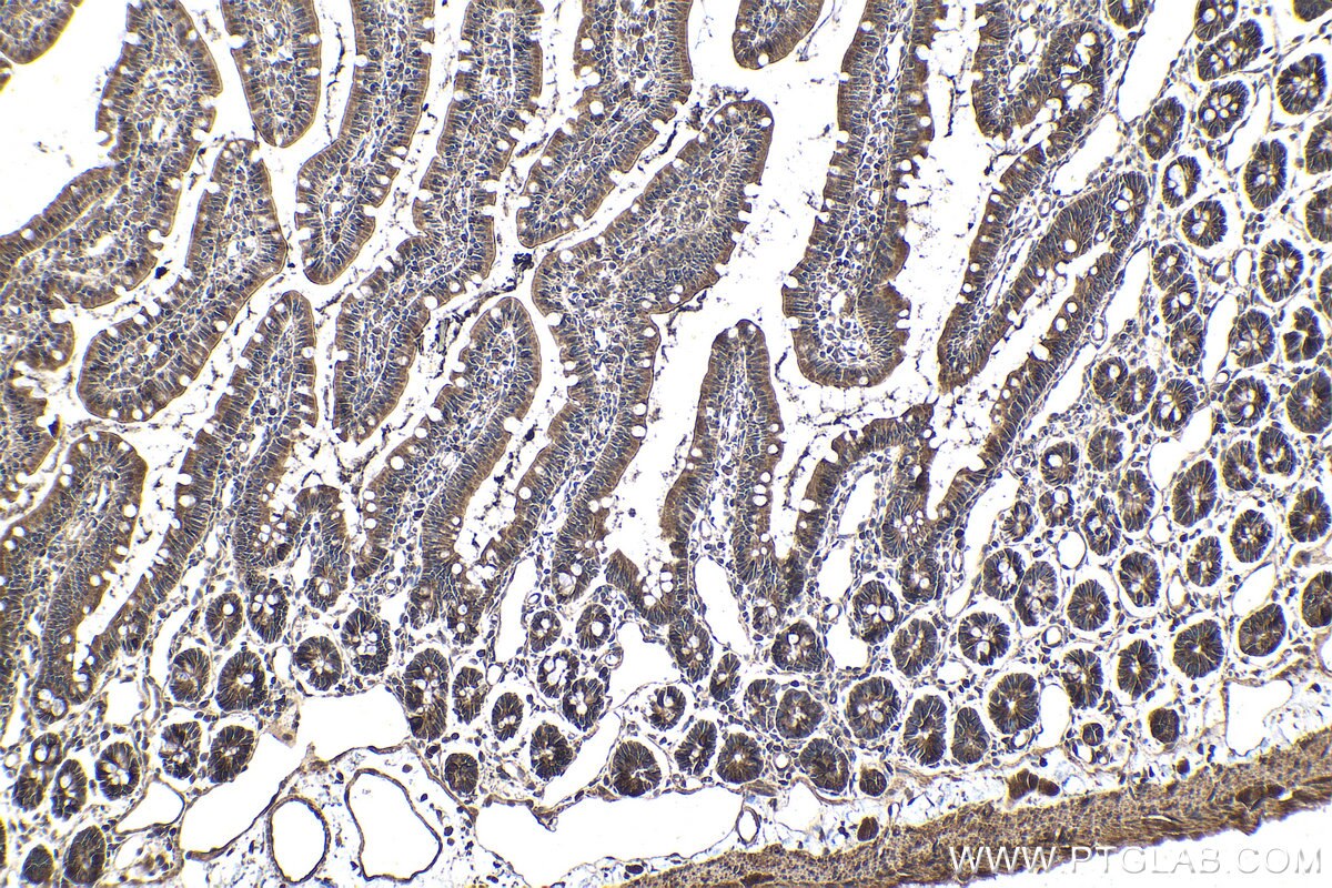 Immunohistochemical analysis of paraffin-embedded rat small intestine tissue slide using KHC1957 (MKKS IHC Kit).