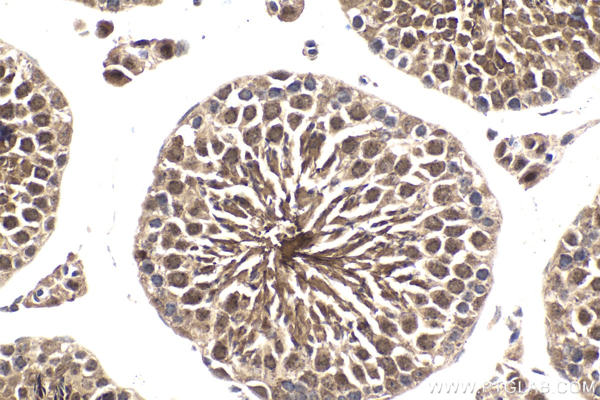 Immunohistochemical analysis of paraffin-embedded mouse testis tissue slide using KHC1634 (MLF1 IHC Kit).