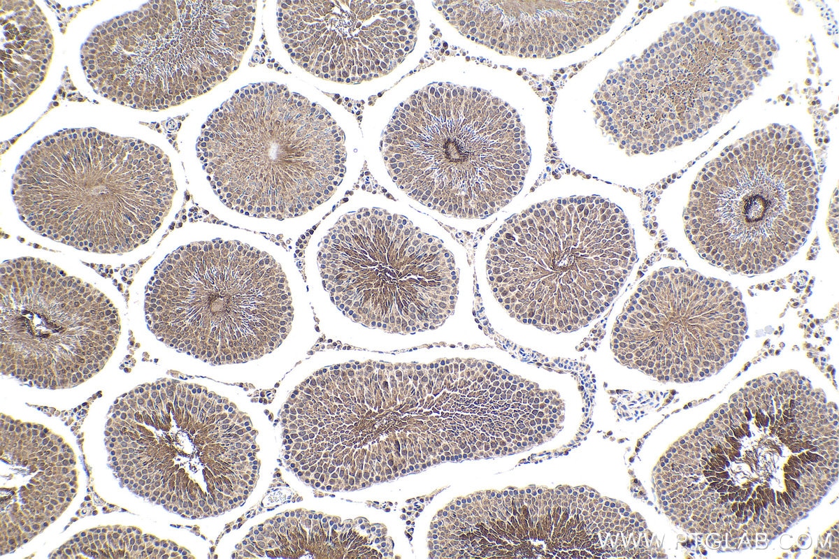 Immunohistochemical analysis of paraffin-embedded rat testis tissue slide using KHC1634 (MLF1 IHC Kit).