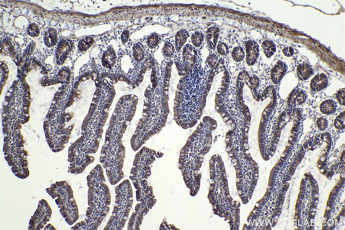 Immunohistochemical analysis of paraffin-embedded rat small intestine tissue slide using KHC1940 (MLXIP IHC Kit).