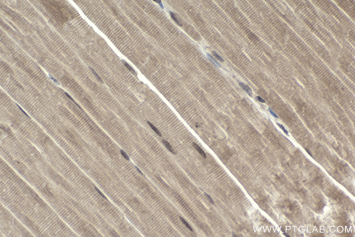 Immunohistochemical analysis of paraffin-embedded rat skeletal muscle tissue slide using KHC1940 (MLXIP IHC Kit).