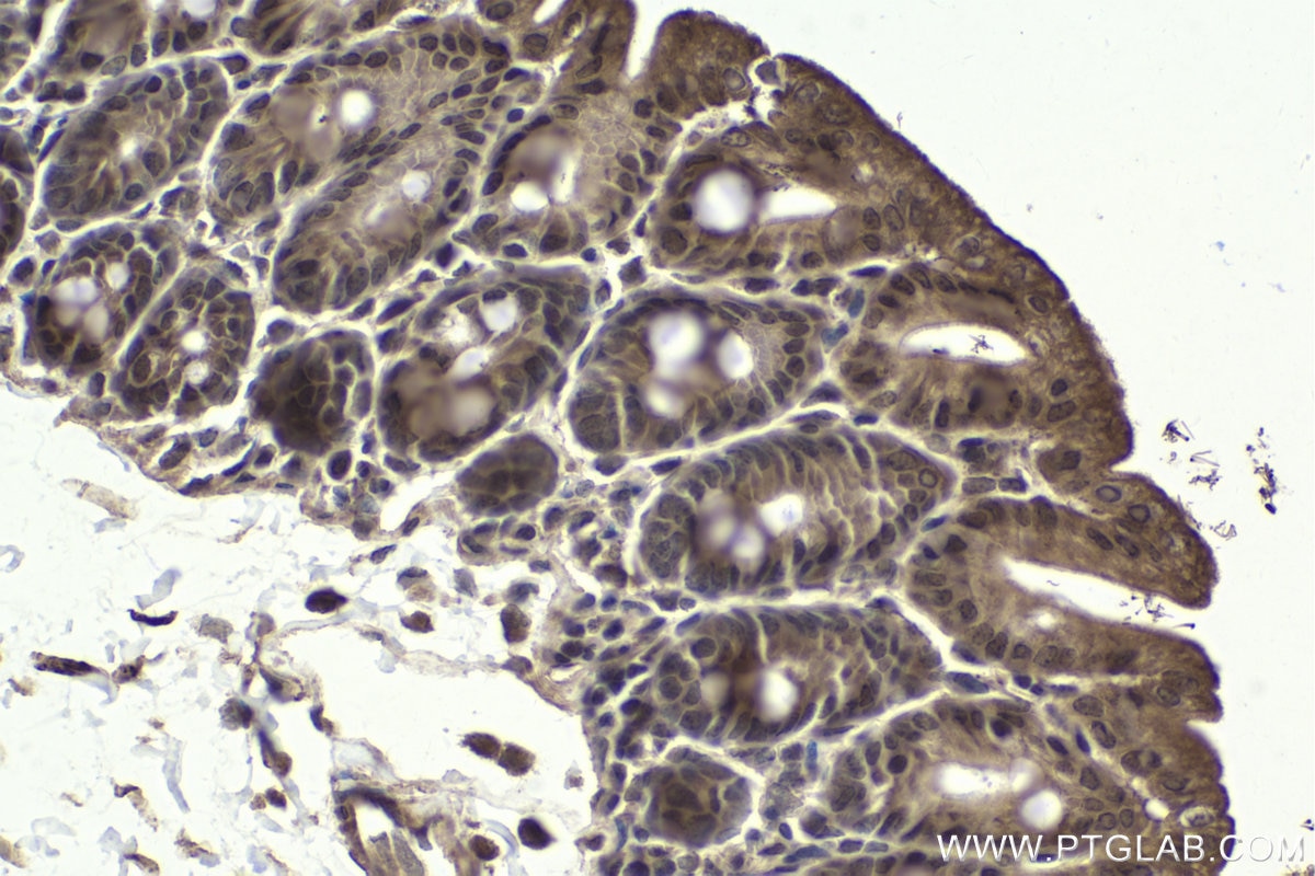 Immunohistochemical analysis of paraffin-embedded mouse small intestine tissue slide using KHC1940 (MLXIP IHC Kit).