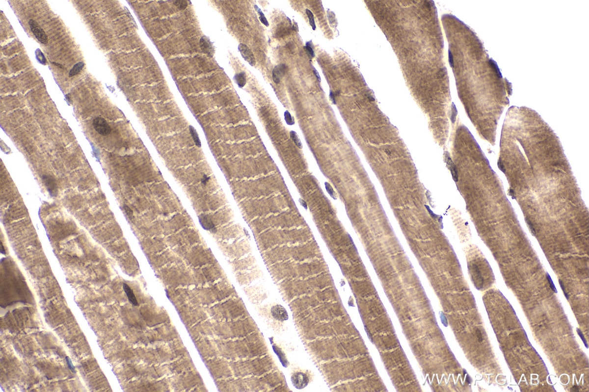 Immunohistochemical analysis of paraffin-embedded mouse skeletal muscle tissue slide using KHC1940 (MLXIP IHC Kit).