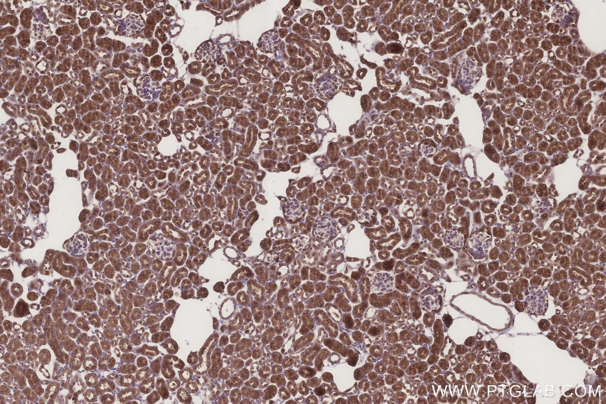 Immunohistochemical analysis of paraffin-embedded mouse kidney tissue slide using KHC3289 (MMGT1 IHC Kit).