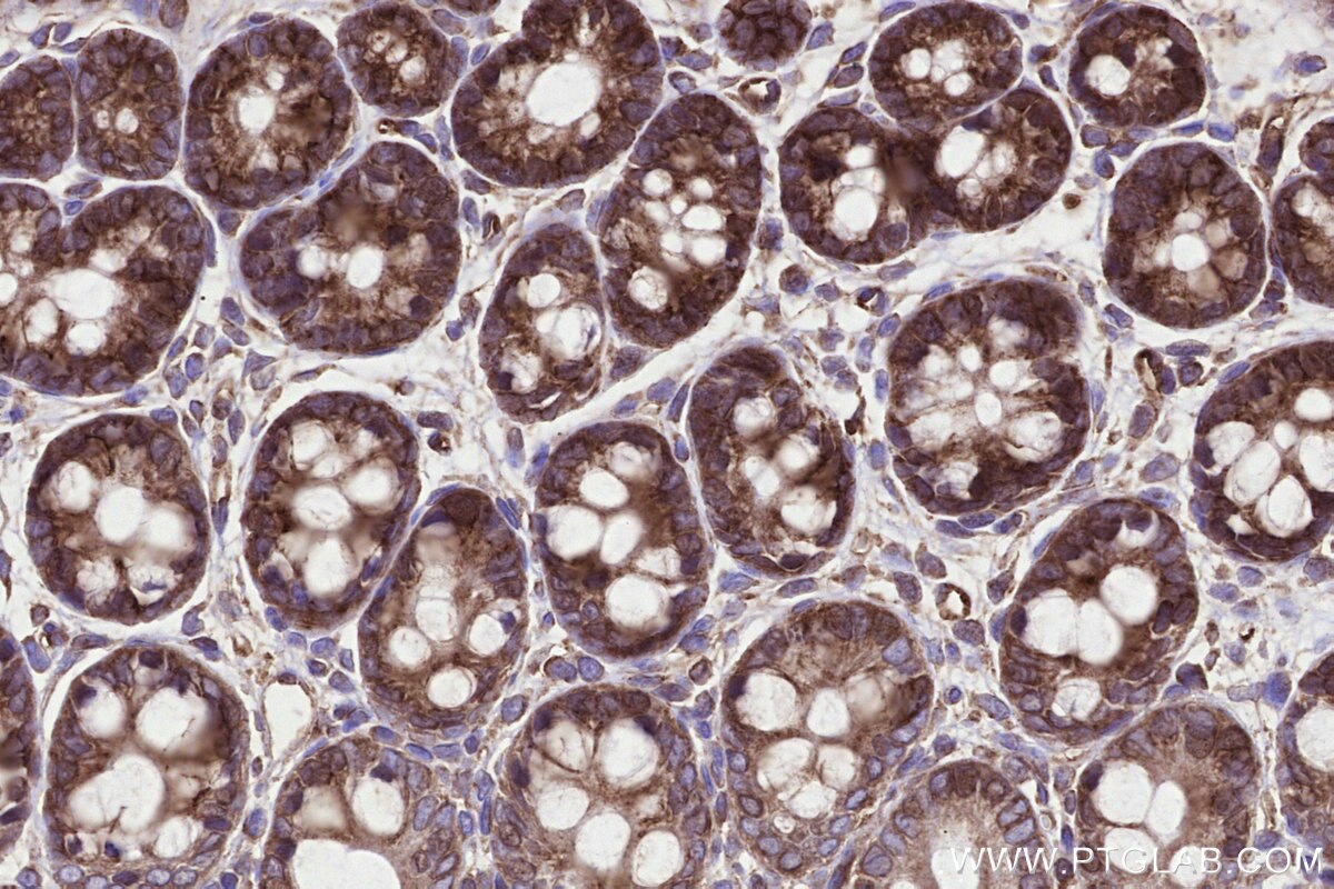 Immunohistochemical analysis of paraffin-embedded rat colon tissue slide using KHC3289 (MMGT1 IHC Kit).
