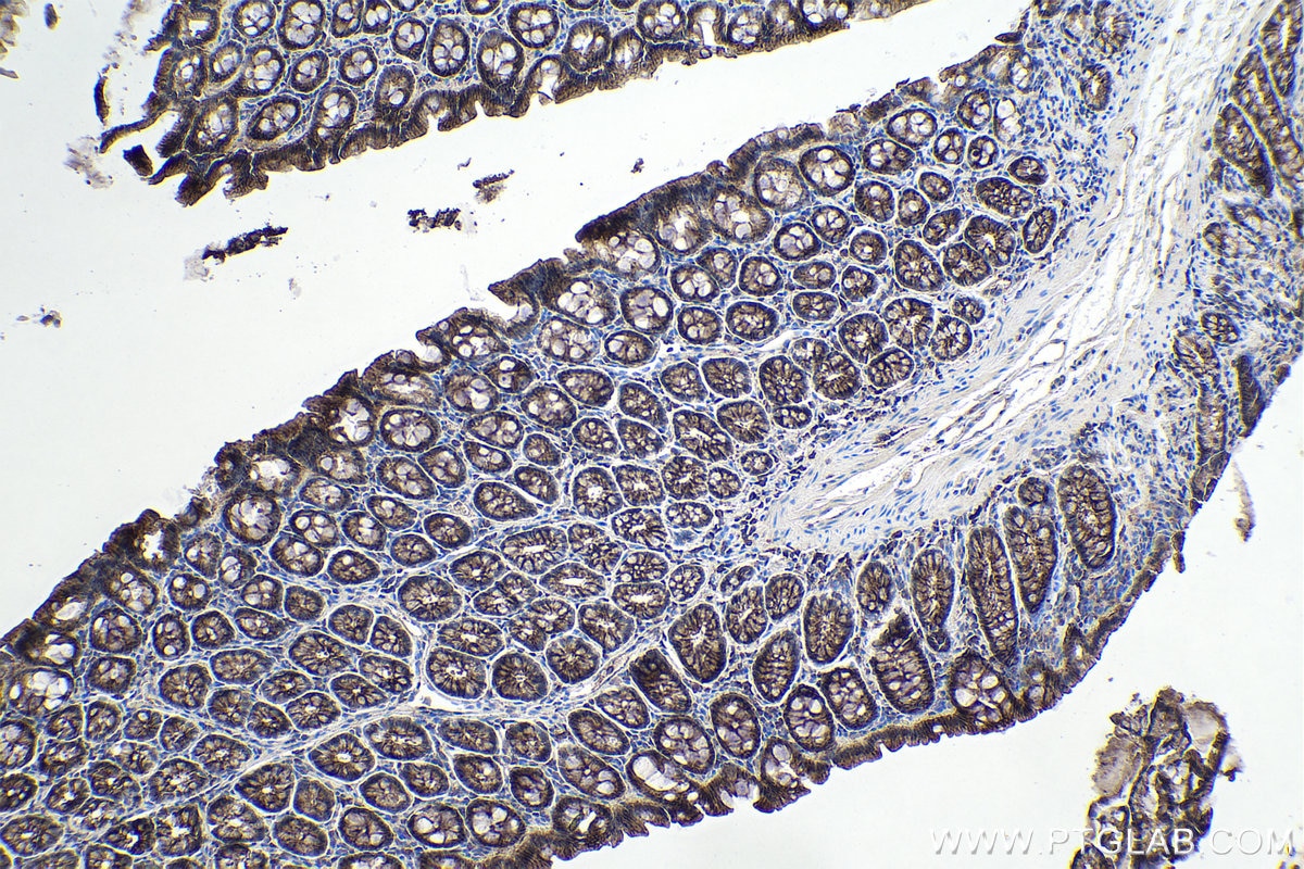 Immunohistochemical analysis of paraffin-embedded rat colon tissue slide using KHC0109 (MMP3 IHC Kit).