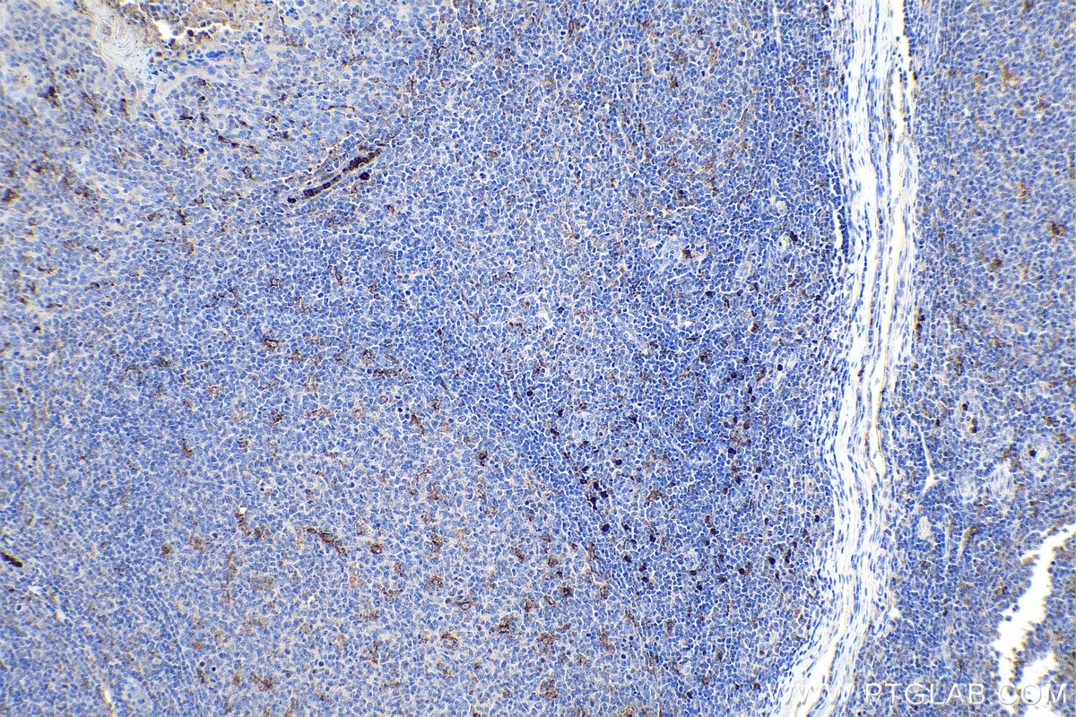 Immunohistochemical analysis of paraffin-embedded human tonsillitis tissue slide using KHC0120 (MMP9 IHC Kit).