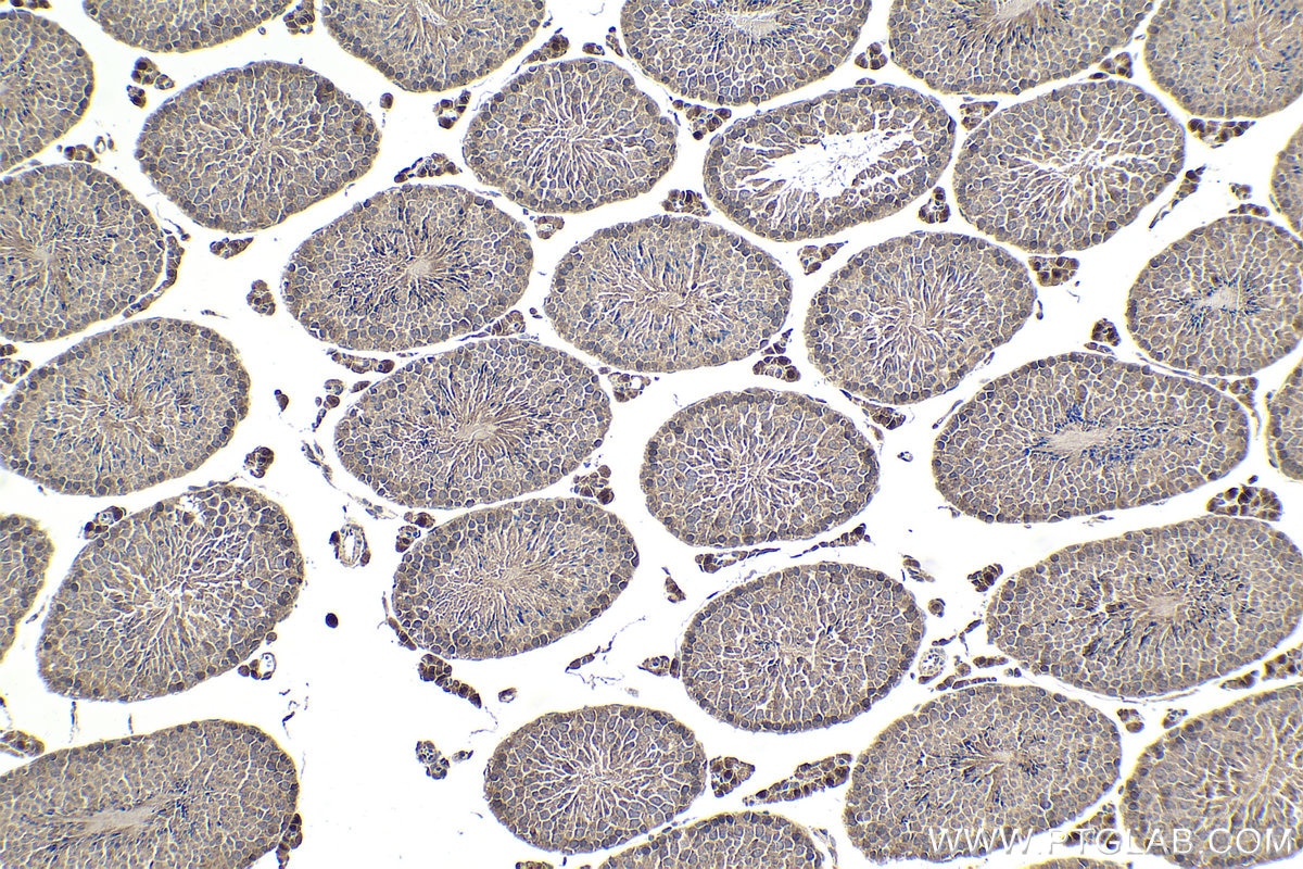 Immunohistochemical analysis of paraffin-embedded mouse testis tissue slide using KHC1886 (MMS19 IHC Kit).