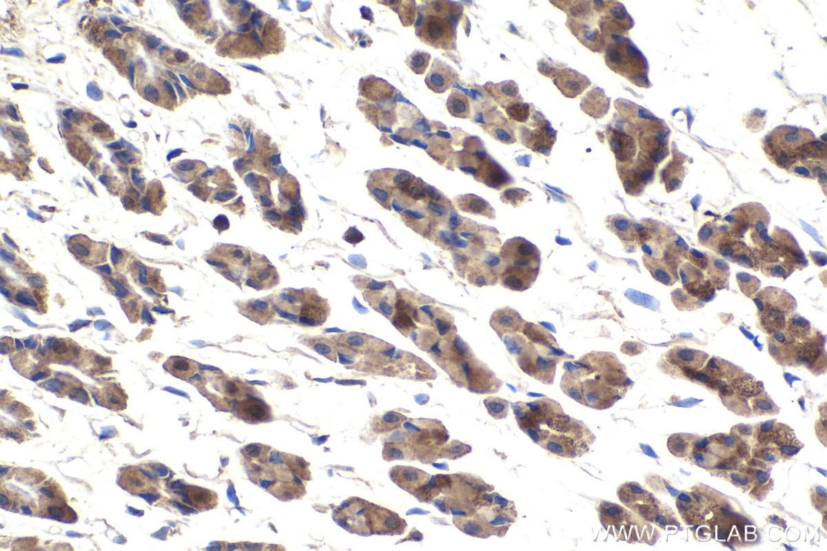 Immunohistochemical analysis of paraffin-embedded rat stomach tissue slide using KHC1886 (MMS19 IHC Kit).