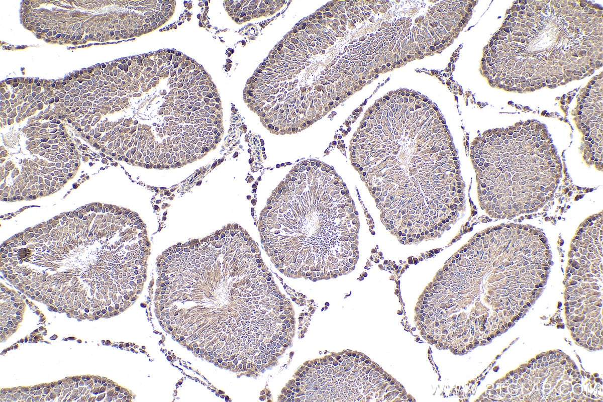 Immunohistochemical analysis of paraffin-embedded rat testis tissue slide using KHC1886 (MMS19 IHC Kit).