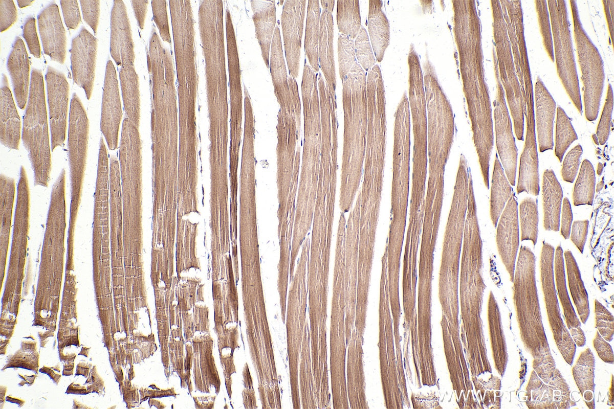 Immunohistochemical analysis of paraffin-embedded mouse skeletal muscle tissue slide using KHC2499 (MMS2 IHC Kit).