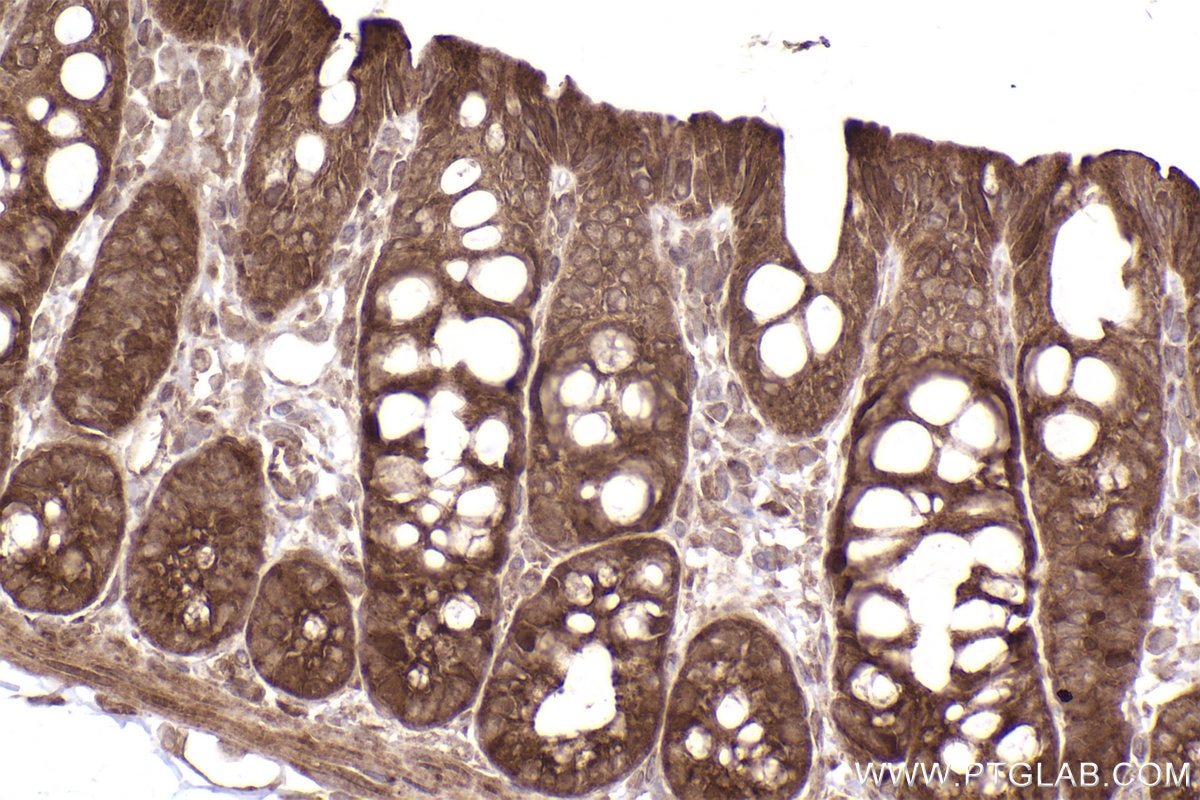 Immunohistochemical analysis of paraffin-embedded rat colon tissue slide using KHC2499 (MMS2 IHC Kit).