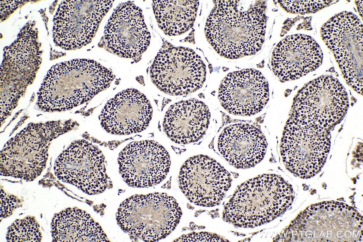 Immunohistochemical analysis of paraffin-embedded mouse testis tissue slide using KHC1620 (MNAT1 IHC Kit).